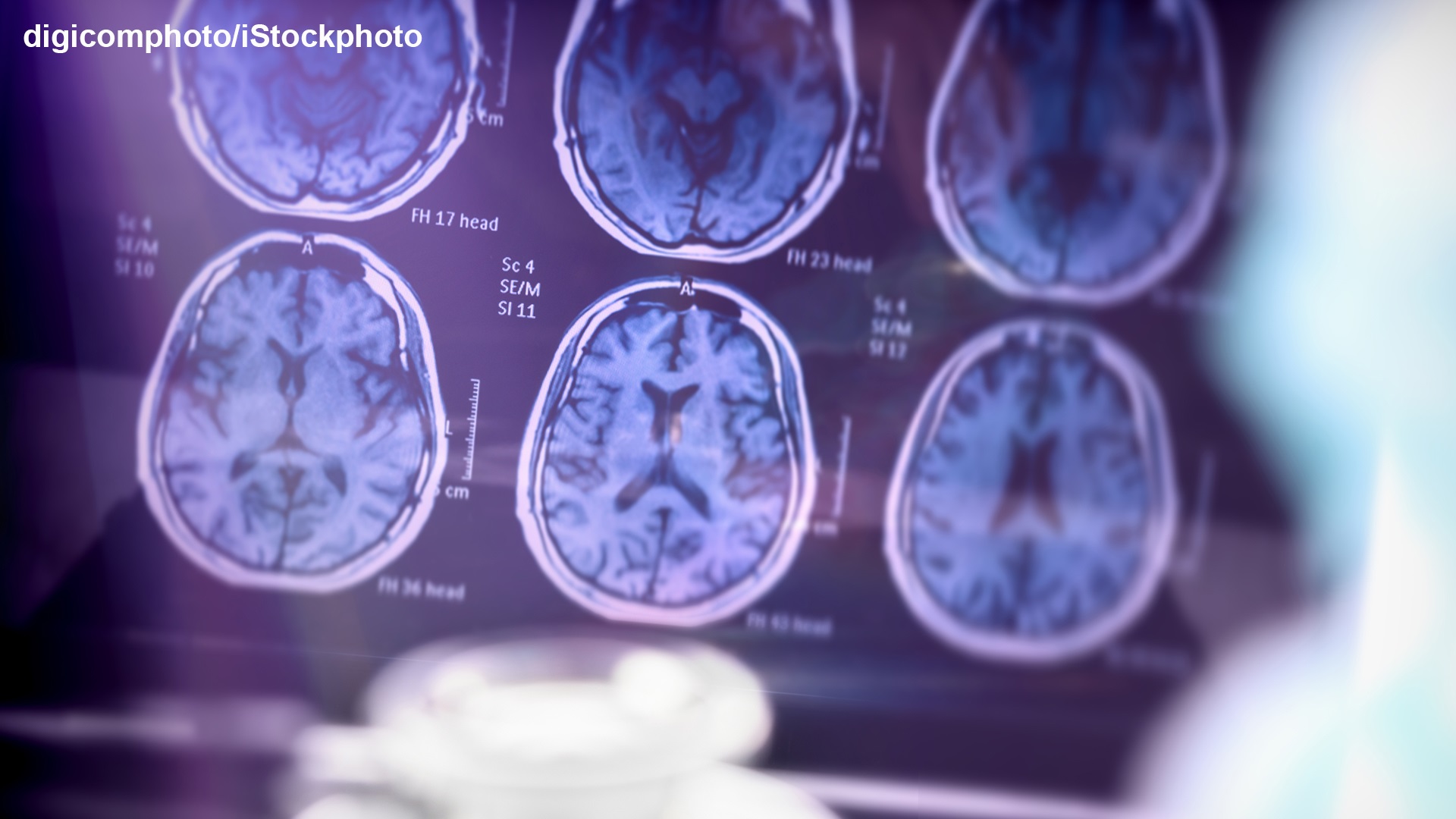 Photo of Nuclear Magnetic Resonance